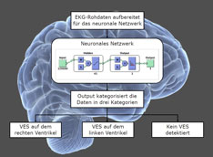 Bachelor-Thesis: Neuronales Netzwerk zur Lokalisierung von Extrasystolen