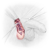 Manuel Ruoss – Vom Penis zur Vagina, Auszug 01