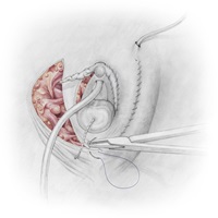 Manuel Ruoss – Vom Penis zur Vagina, Auszug 03