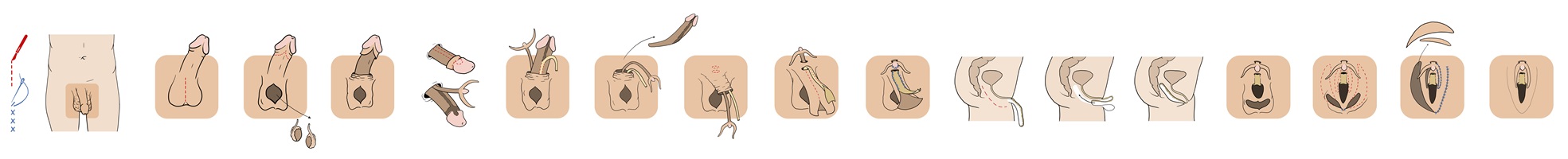 Manuel Ruoss – Vom Penis zur Vagina, Auszug 04