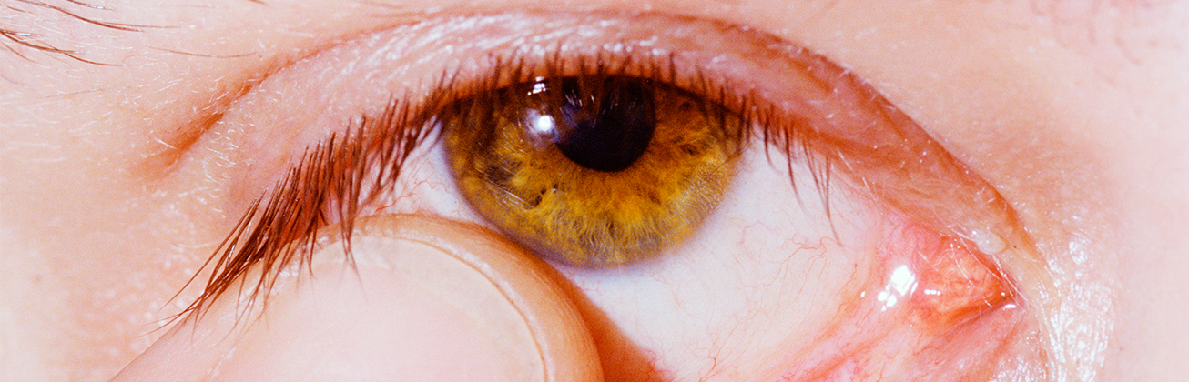 Nahaufnahme eines Auges, auf das ein Finger zeigt