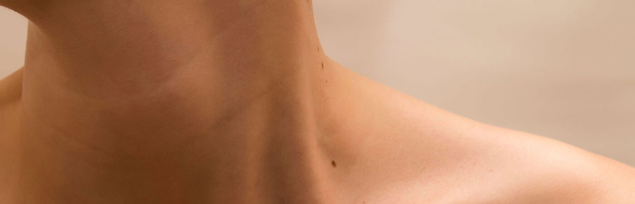 Frauenhals mit Leberflecken