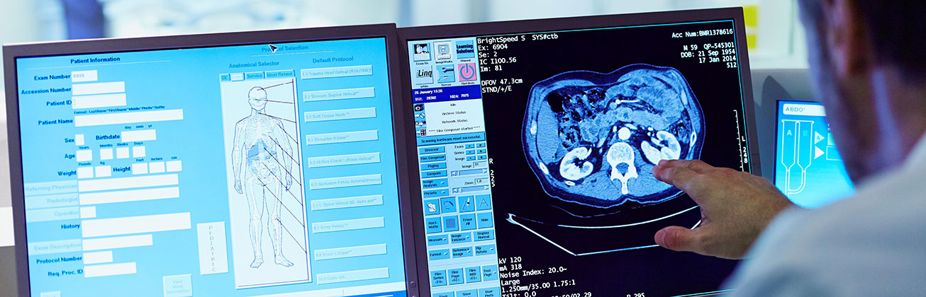 Bildschirm Computer Tomograph
