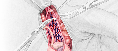Anatomische Zeichnung von Geschlechtsteil