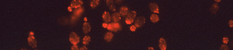 Hefezellen Mikroskopaufnahme