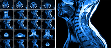 Röntgenaufnahme Wirbelsäule