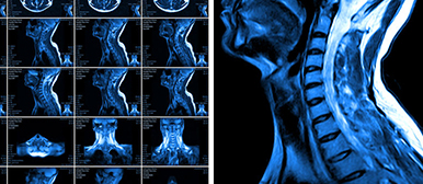 Röntgenbilder Rumpf